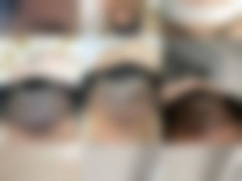 韩国pure整形皮肤科患者常见问题解答（精选 ）