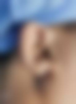 五、通化市谷海龙医疗美容真实实例参考