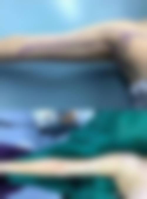 解密！不同部位吸脂，拆线时间大不同！