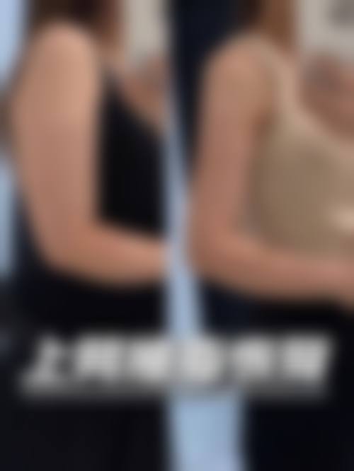 四、手臂溶脂成效对比，眼见为实