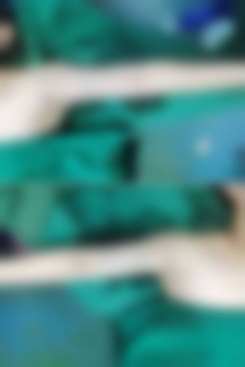 手臂溶脂和抽脂哪个好？看核心区别+费用区间，溶脂3000-8000元/次更适合轻量瘦臂