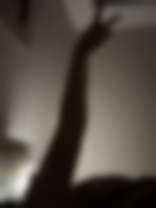 六、手臂溶脂和抽脂的修复周期对比