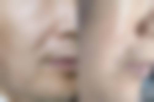 6、洛阳中信中 心医院整形科口碑好评反馈