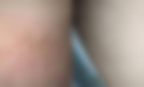 二、新疆医科大学第一附属医院(整形科)简介概况