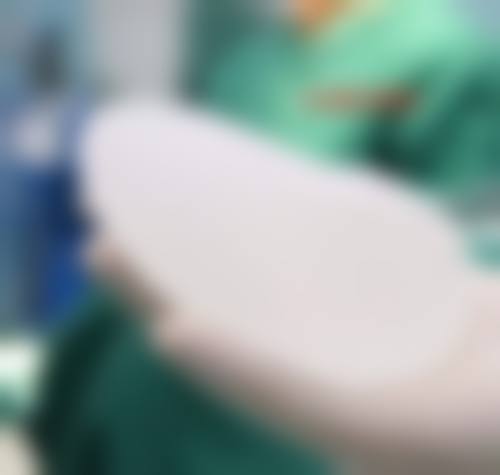 四、等待修复期的护理与修复周期