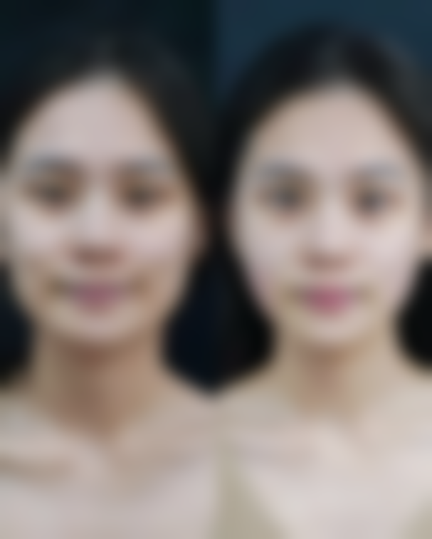 三、柳在亿医生技术水平高