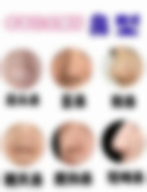 五、隆鼻感染的科学应对方案