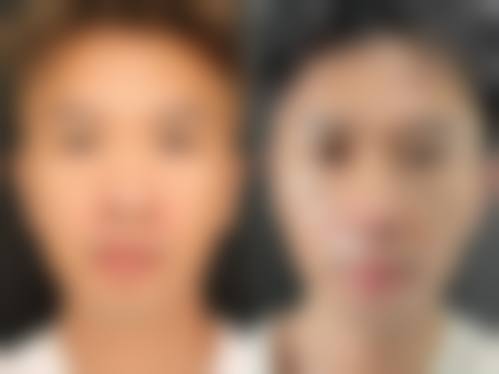 三、逆行性感染的具体诱因