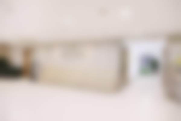 3. 面诊体验：比我还懂我想要的双眼皮