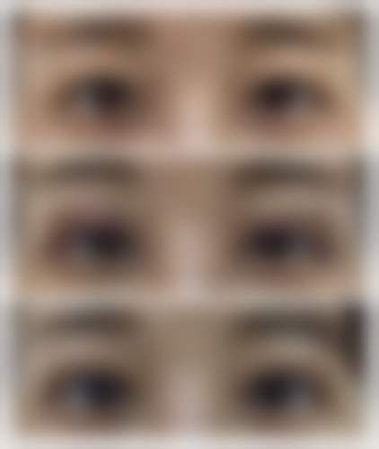 四、韩国普瑞美整形医院正规靠谱吗