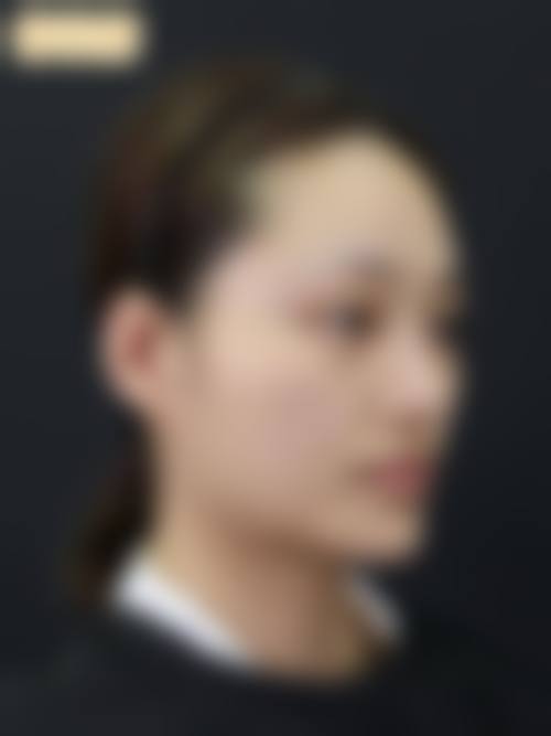 重庆潘多拉整形修复医院特色技术及优质服务