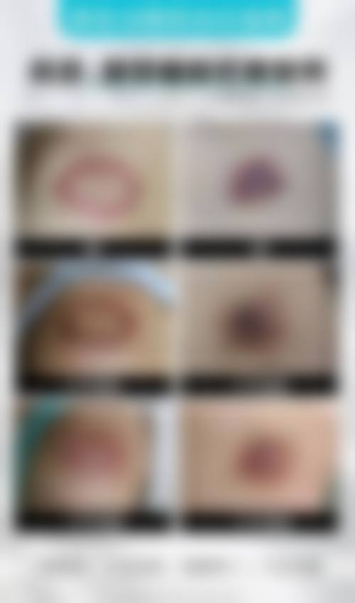 八、西安光仁丁医生整形医院预约与就诊指引