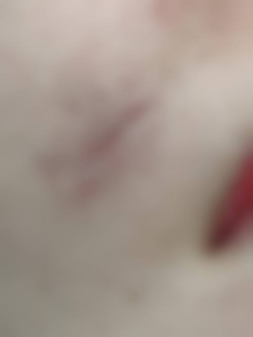 六、西安美丽妍妍整形医院收费参考与价格区间