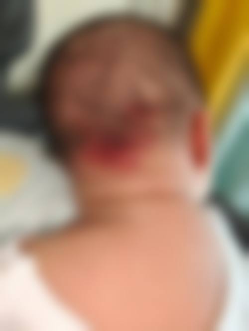 天津河东菲丝澜医学美容整形医院患者常见问题解答（精选 ）