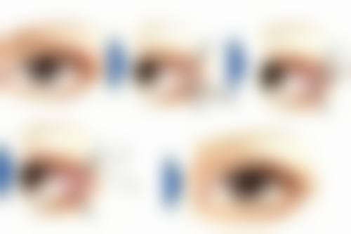 三、bt胶原枪的全方面抗衰成效