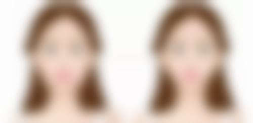 市面常见瘦脸针制剂的剂量特点是怎样的？