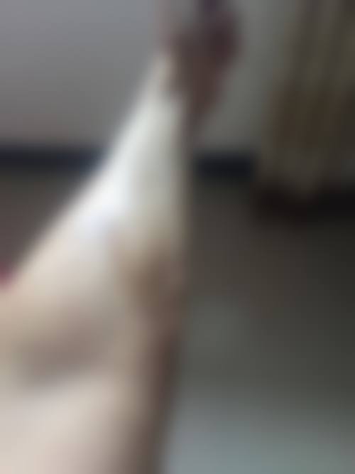 患者常见问题解答（精选）
