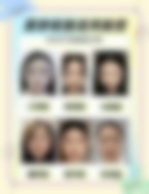 瘦脸针成效维持与随访有哪些要点？