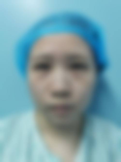 六、如何根据自身需求选择去眼袋眼霜？