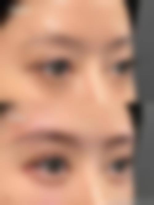 四、成效持久性解析：哈颜玻尿酸能维持多久？性价比如何