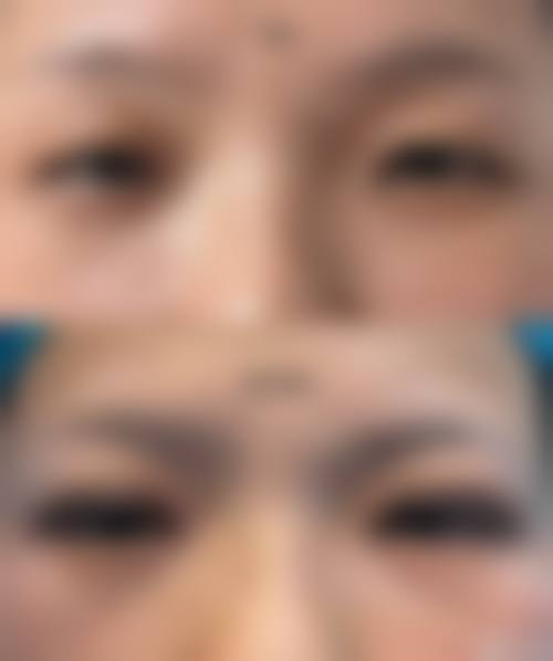 四、去眼袋眼霜的使用方法和注意事项有哪些？