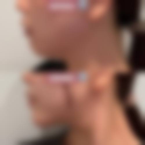 九、如何选择面部吸脂的医院和医生