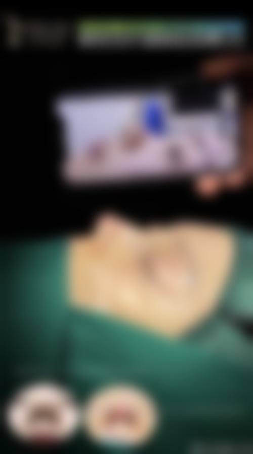 手术方式如何影响隆鼻成效维持时间？
