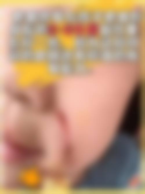 韩国伊特整形医院眼整形技术优势