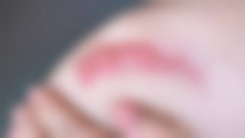 三、祛疤膏使用疗程要多久