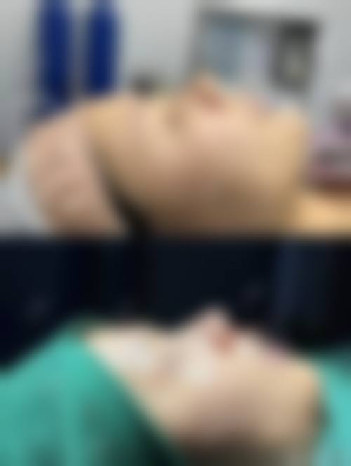 四、邹东旭医生收费价格