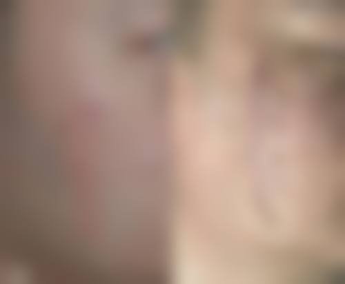 南通南洋整形医院口碑如何？来看患者真实评价
