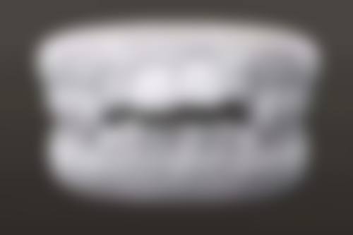八、患者常见问题解答(精选 )