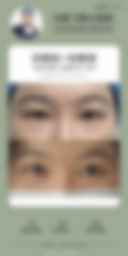 付时章医生擅长项目