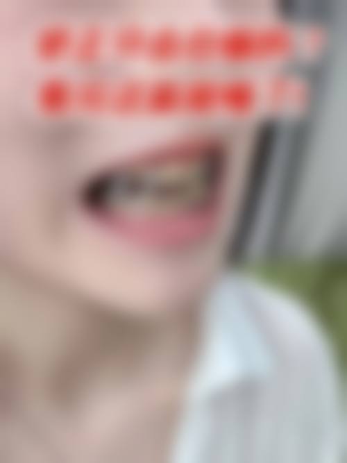 五、汕头德彬口腔诊所价格表区间/收费标准说明