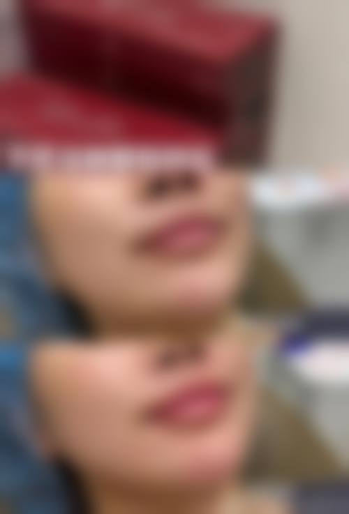 七、怎么判断自己是否适合阴道紧缩