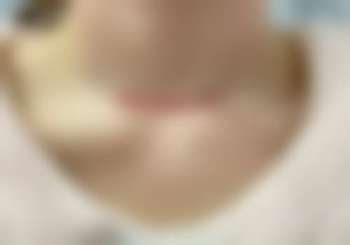 三、天门市第二人民医院整形美容科开展项目及特色技术