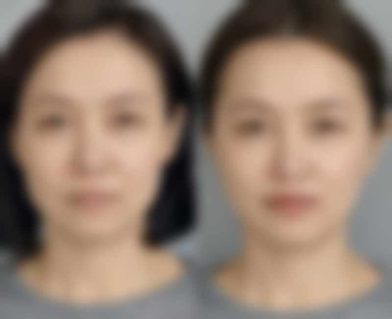 三、用什么化妆品去眼袋成效好？不同肤质专属推荐