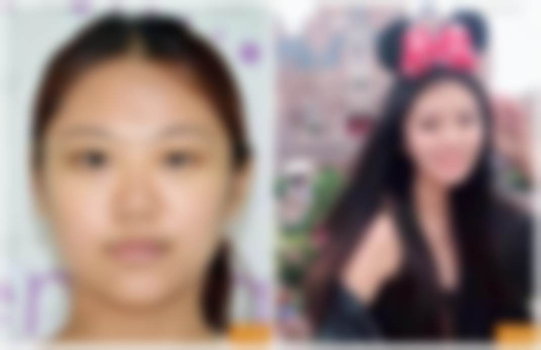 李梦莹医生技术如何?真人实例告诉你成效