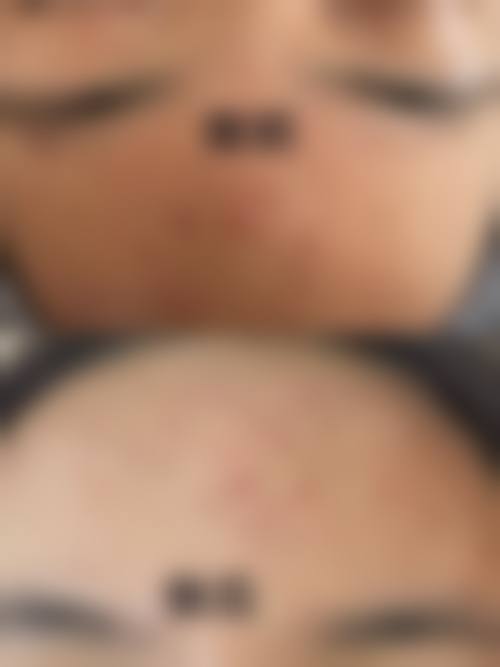 1、主要做的三大诊疗项目