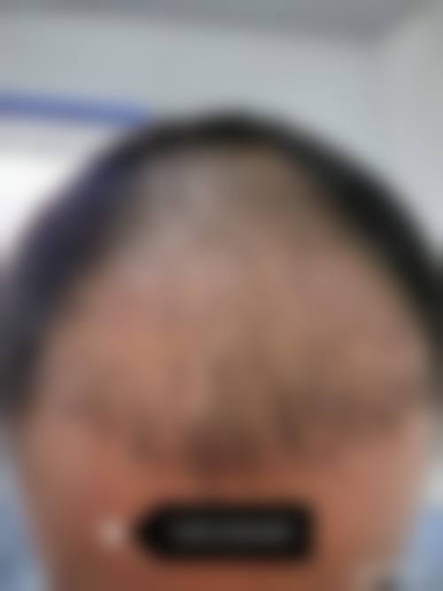 七、梁霁医生整形项目价格表/收费标准一览