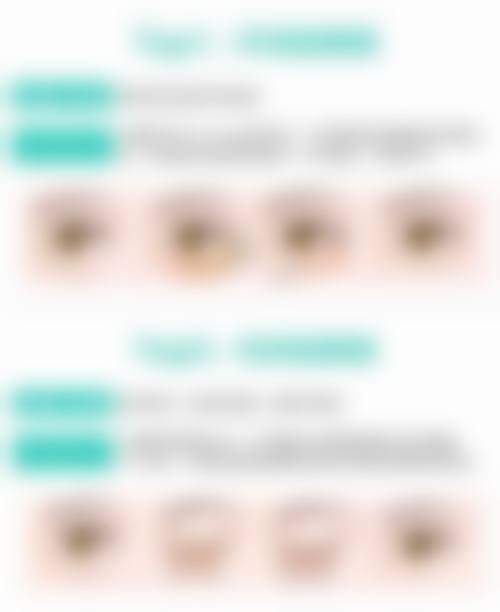 九、埋线双眼皮手术医生和医院的选择