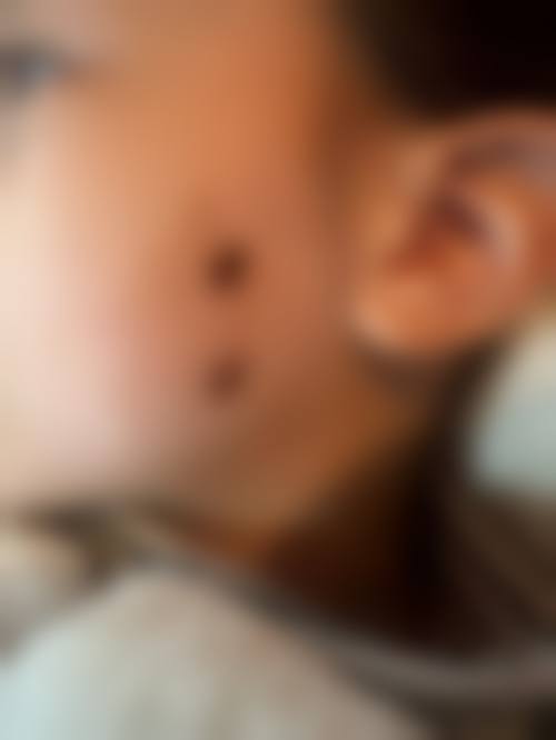 五、成都武侯芮思整形医院真实实例参考