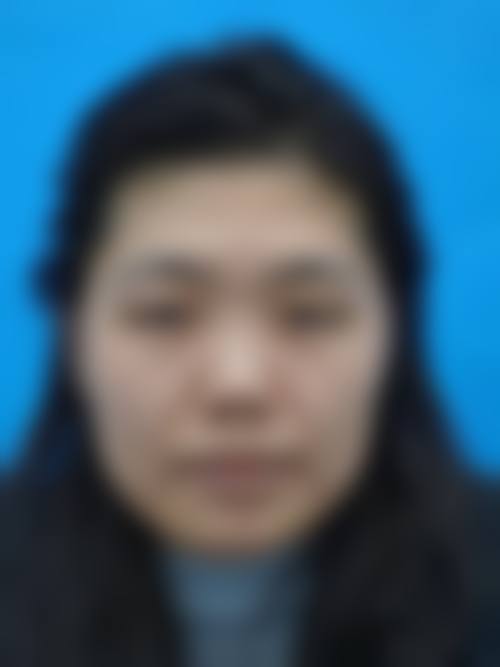 四、埋线双眼皮适合人群