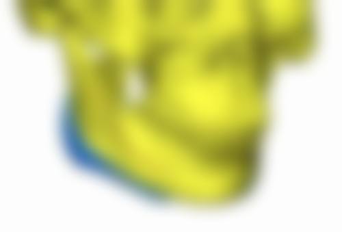 七、哪些人适合做丝丽516？如何避免踩坑