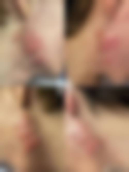 三、为什么要找【疤痕专科】医生面诊