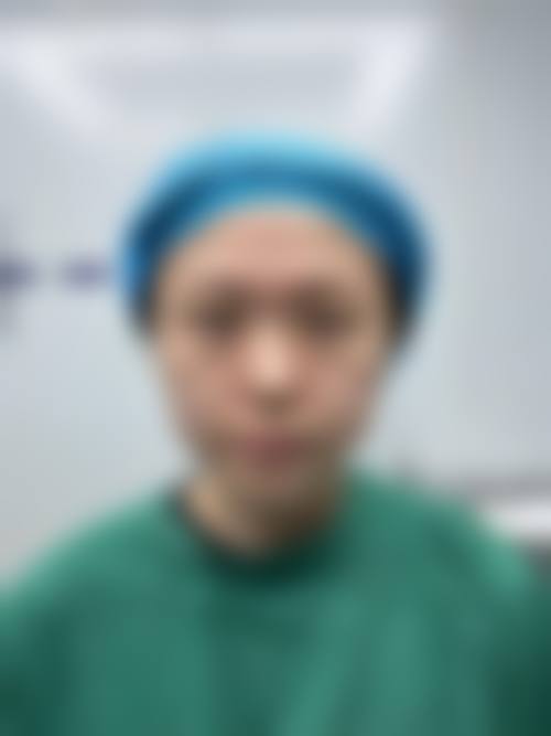 四、成都素美做双眼皮紧致的特色
