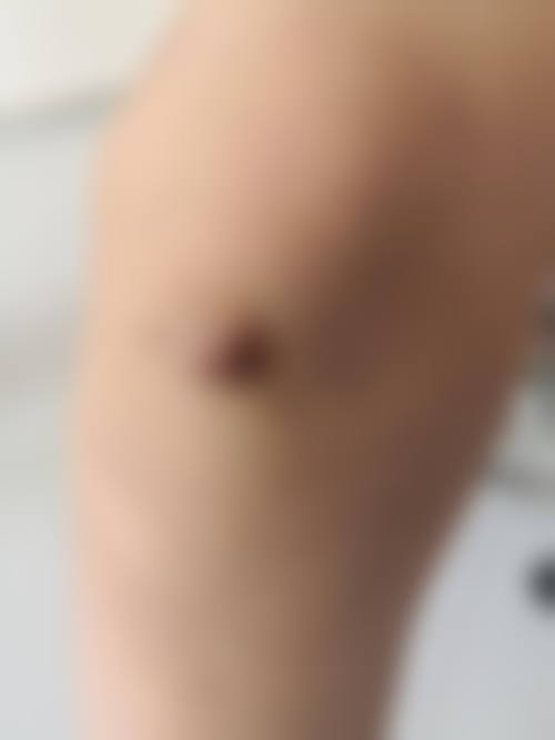 2、聊城光明医疗美容门诊部是正规医院吗？正规资质查阅：