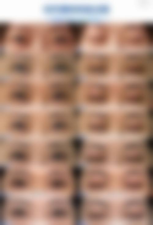 八、双眼皮修复的适合人群