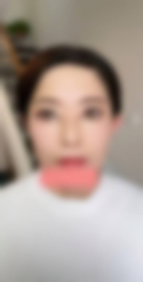 三、割了双眼皮眉眼间距太近的应对方法
