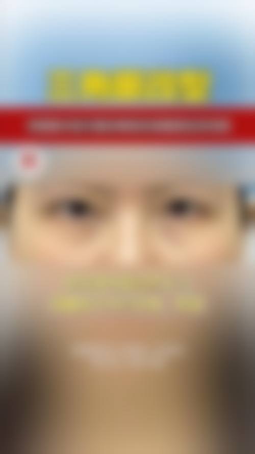 六、割双眼皮忌嘴多久修复自然
